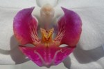 Purpura